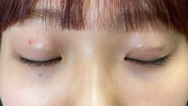 Postoperative Condition Part 1