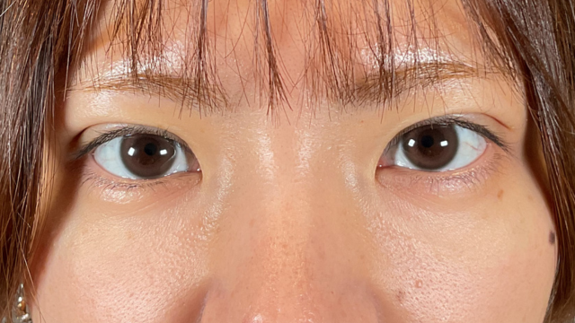 Postoperative Condition Part 1