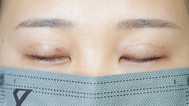 Postoperative Condition Part 1