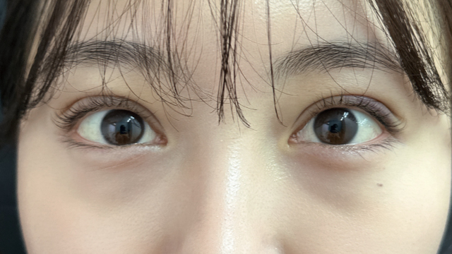 Postoperative Condition Part 1