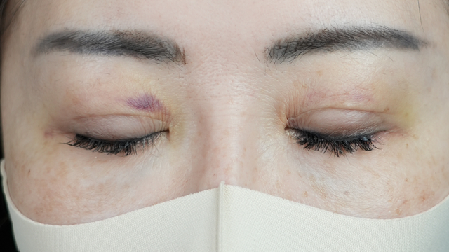 Postoperative Condition Part 1