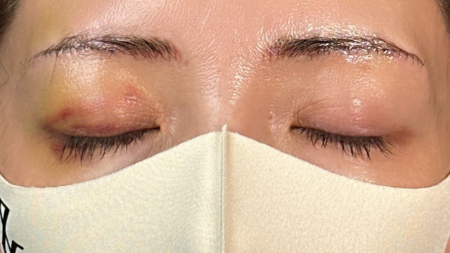 Postoperative Condition Part 1