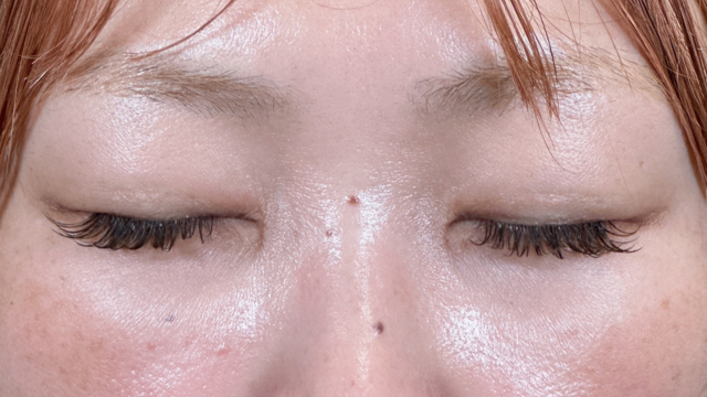 Postoperative Condition Part 1