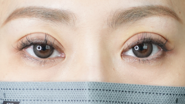 Postoperative Condition Part 1