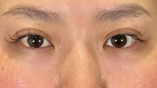 Postoperative Condition Part 1