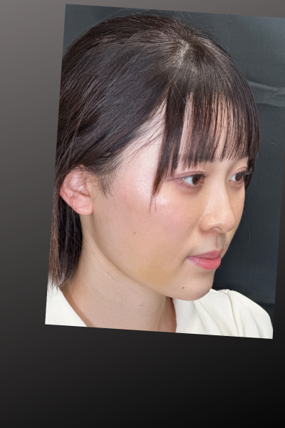 Postoperative Condition Part 1