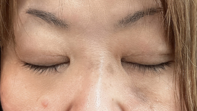 Postoperative Condition Part 1