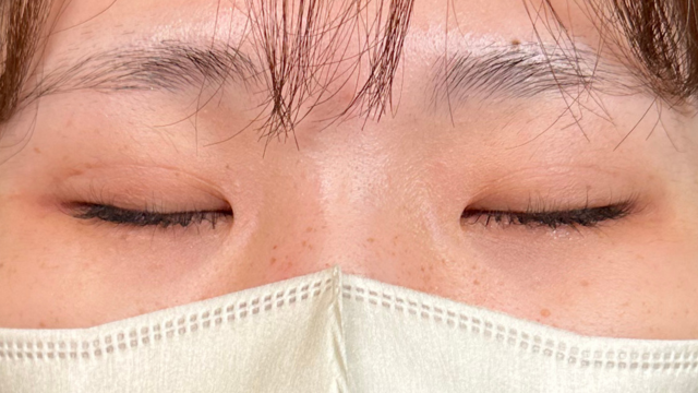 Postoperative Condition Part 1