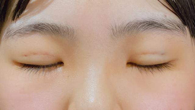 Postoperative Condition Part 1