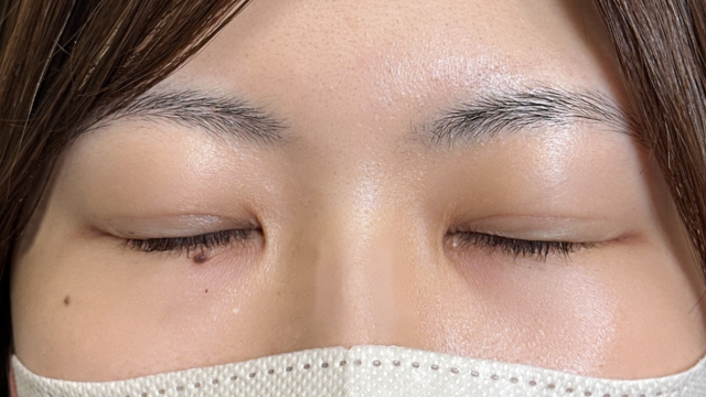 Postoperative Condition Part 1