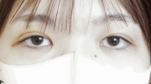 Postoperative Condition Part 1