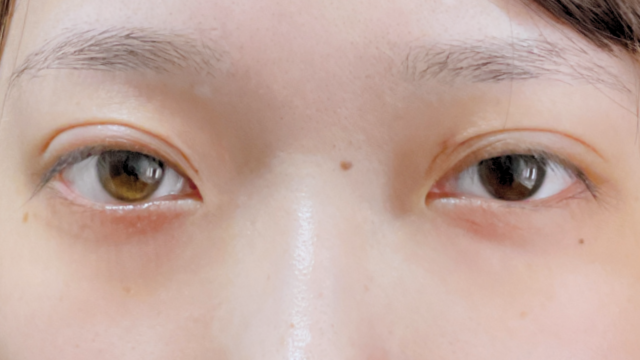 Postoperative Condition Part 1