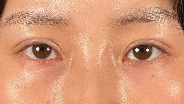 Postoperative Condition Part 1