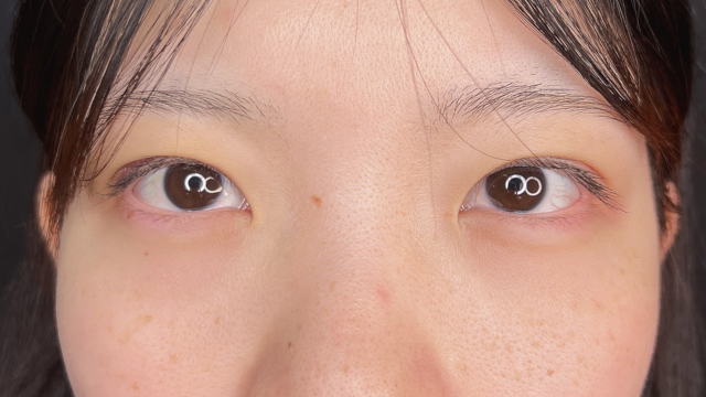 Postoperative Condition Part 1