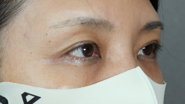 Postoperative Condition Part 1