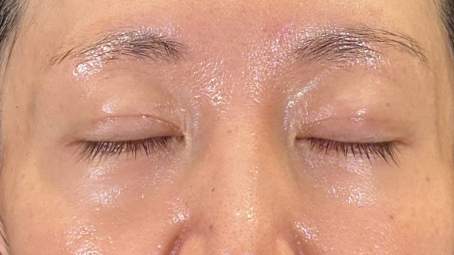 Postoperative Condition Part 1