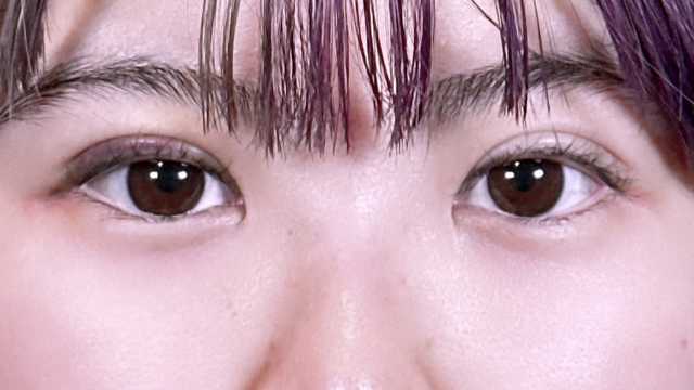 Postoperative Condition Part 1