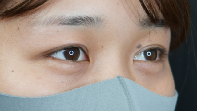 Postoperative Condition Part 1