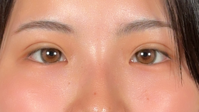 Postoperative Condition Part 1