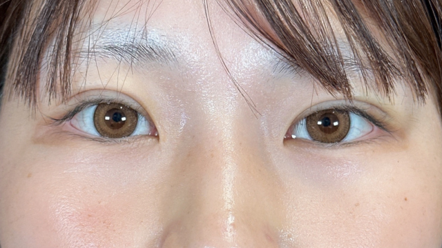 Postoperative Condition Part 1