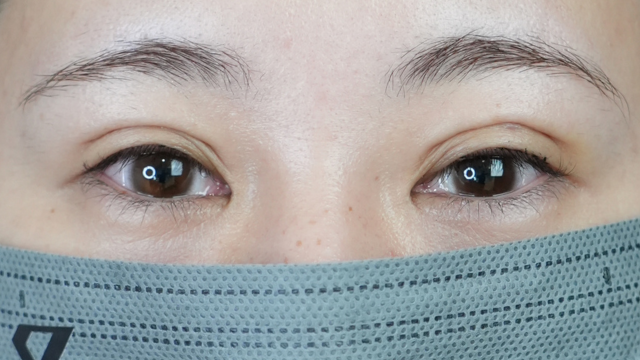 Postoperative Condition Part 1