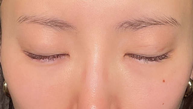 Postoperative Condition Part 1