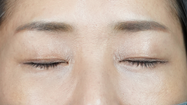 Postoperative Condition Part 1