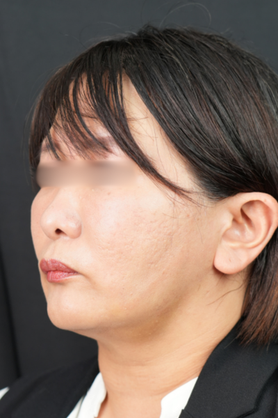 Postoperative Condition Part 1