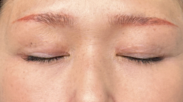 Postoperative Condition Part 1