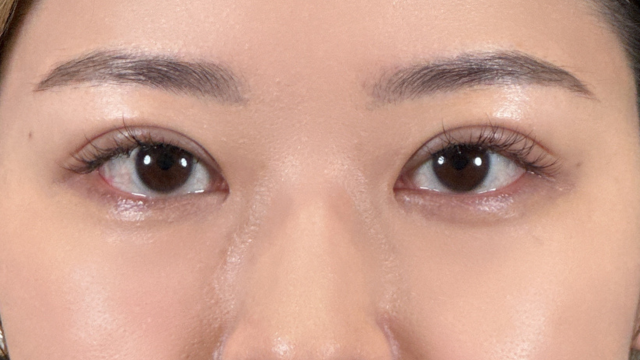 Postoperative Condition Part 1