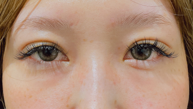 Postoperative Condition Part 1