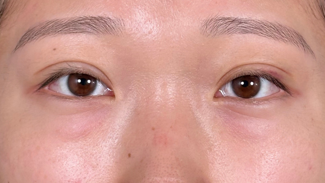 Postoperative Condition Part 1