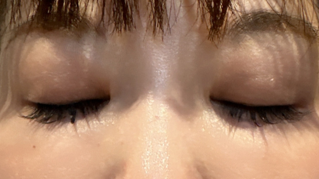 Postoperative Condition Part 1