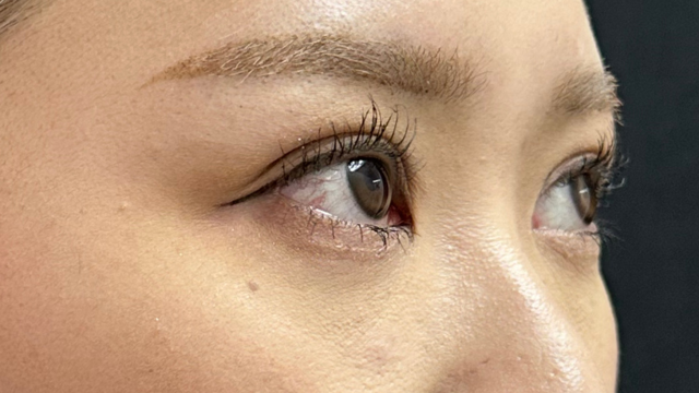 Postoperative Condition Part 1