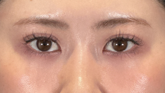 Postoperative Condition Part 1