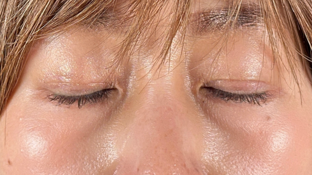 Postoperative Condition Part 1