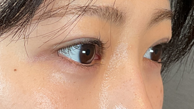 Postoperative Condition Part 1