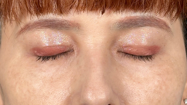 Postoperative Condition Part 1