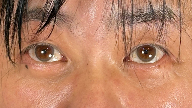 Postoperative Condition Part 1