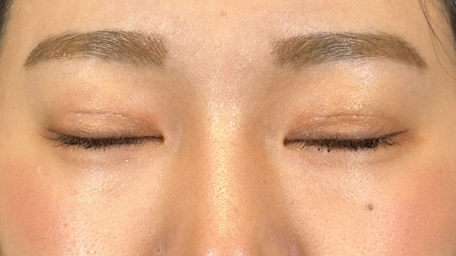 Postoperative Condition Part 1