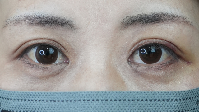 Postoperative Condition Part 1