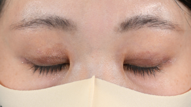 Postoperative Condition Part 1