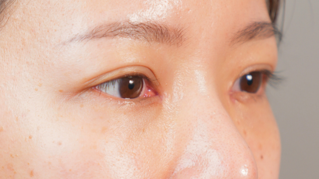 Postoperative Condition Part 1