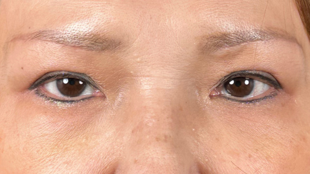 Postoperative Condition Part 1