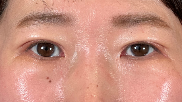 Postoperative Condition Part 1