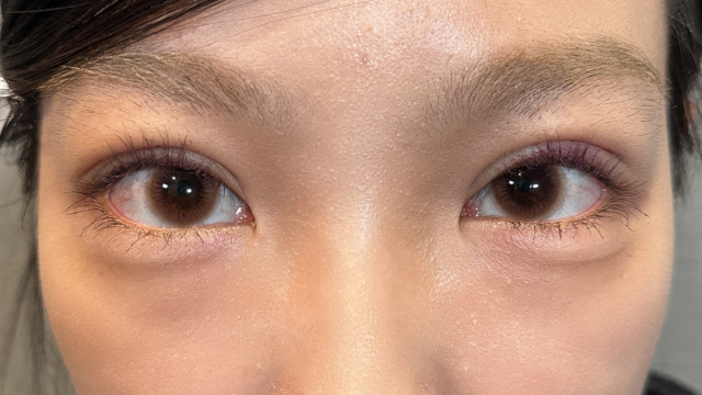 Postoperative Condition Part 1