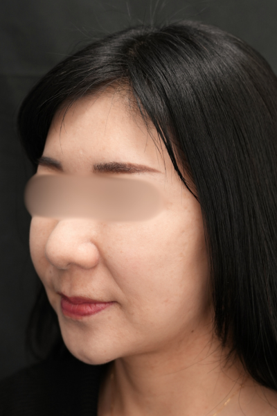 Postoperative Condition Part 1