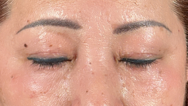 Postoperative Condition Part 1