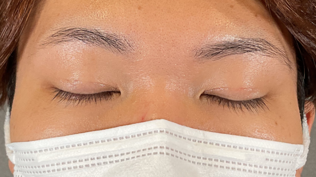 Postoperative Condition Part 1