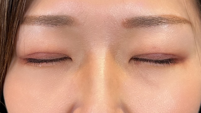 Postoperative Condition Part 1